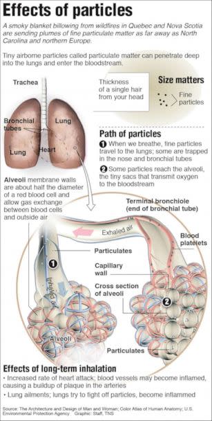 PHOTO: A graphic shows the damage particulate matter can do to your lungs. (Tribune News Service via Newscom)