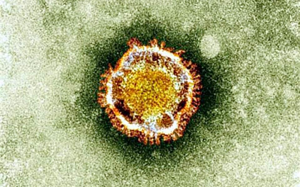 Scientists say that recreating coronavirus will allow for better diagnosis around the world - AFP