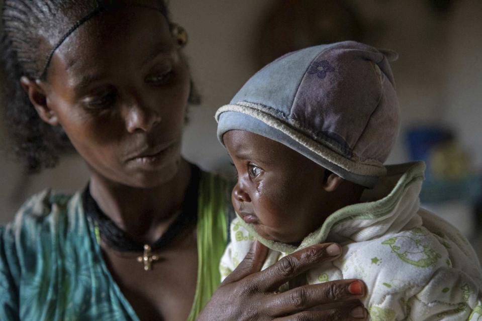 FILE - In this Tuesday, July 20, 2021 file photo, mother Ababa, 25, comforts her baby Wegahta, 6 months, who was identified as severely acutely malnourished, in Gijet in the Tigray region of northern Ethiopia. In an interview with The Associated Press Tuesday, Sept 28, 2021, the United Nations humanitarian chief Martin Griffiths calls the crisis in Ethiopia a "stain on our conscience" as children and others starve to death in the Tigray region under what the U.N. calls a de facto government blockade of food, medical supplies and fuel. (Christine Nesbitt/UNICEF via AP, File)