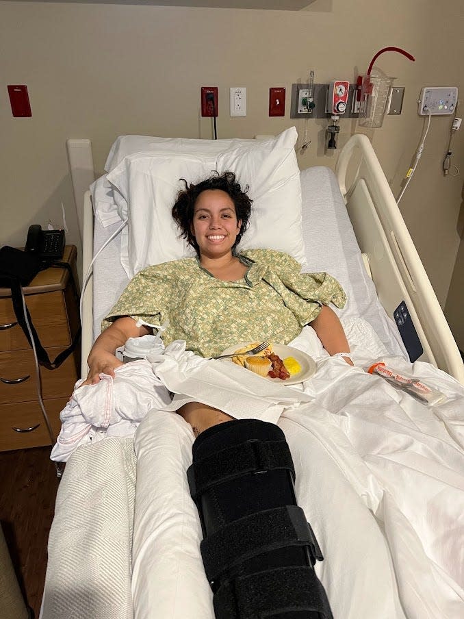 Karina Castillo spent a month in the hospital after her car accident. With both legs broken and a broken arm, she had to start physical therapy in small steps.