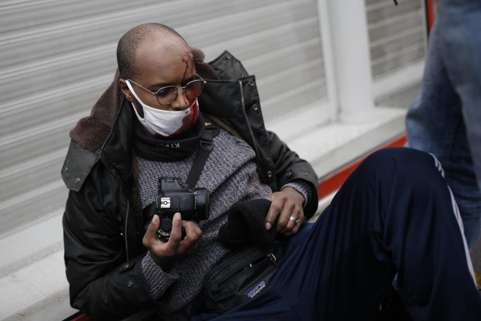 A man has blood on his face during a protest against a proposed bill , Saturday, Dec.12, 2020 in Paris. The bill's most contested measure could make it more difficult for people to film police officers. It aims to outlaw the publication of images with intent to cause harm to police. The provision has caused such an uproar that the government has decided to rewrite it. Critics fear the law could erode press freedom and make it more difficult to expose police brutality. (AP Photo/Lewis Joly)