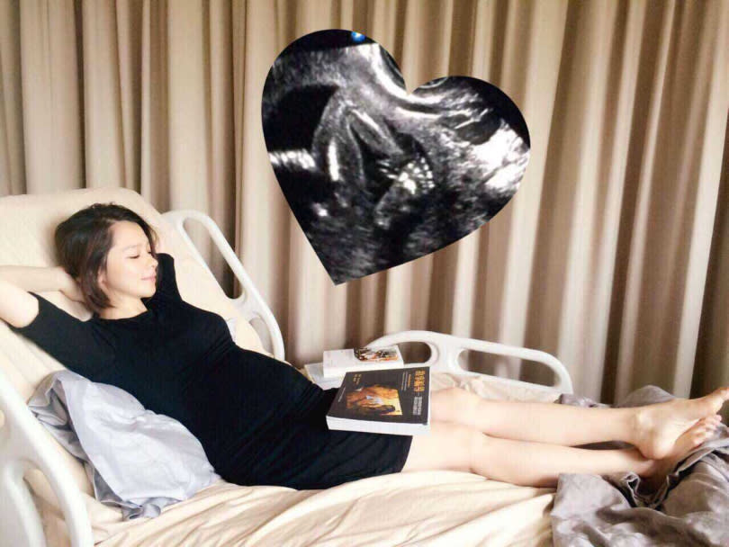 徐若瑄再度回顧自己之前懷孕臥床的照片。（圖／翻攝自徐若瑄臉書）