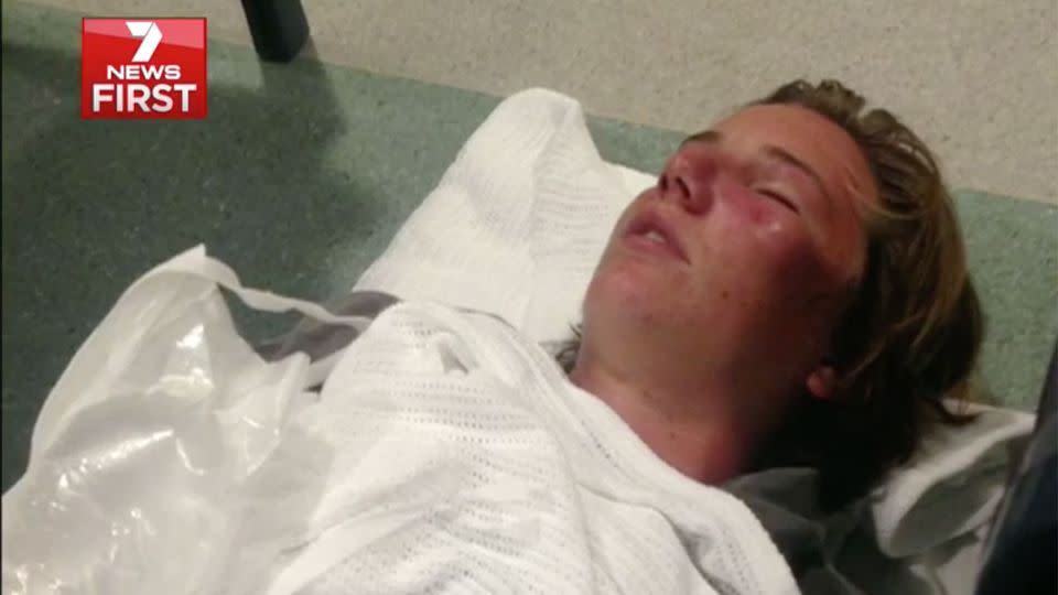 Tom Blann knocked out cold and left with a broken eye socket, a broken nose and severe concussion. Photo: 7 News