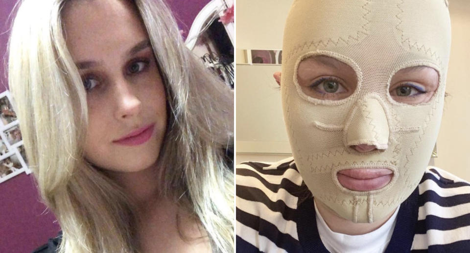 Stephanie Browitt, 24, pictured before and after she was burnt by the White Island volcanic eruption.