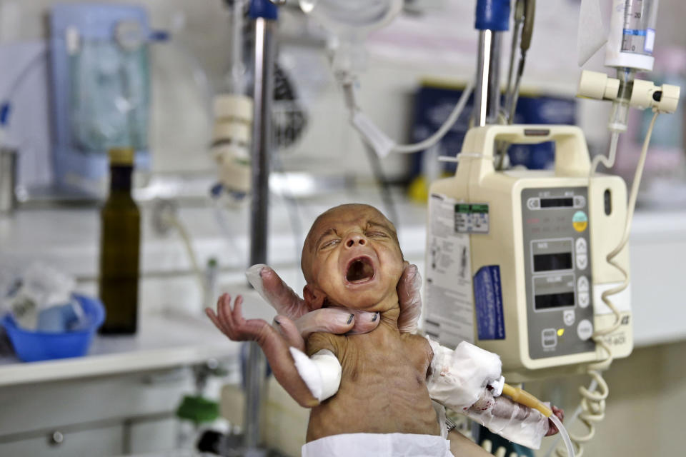 In this Monday, Dec. 30, 2013 photo, a newborn baby cries while is held by a nurse in the Neonatal Intensive Care Unit of the Mofid Children's Hospital in Tehran, Iran. Having curbed birth rates for two decades, Iran is once again promoting a baby boom to help make up for its graying population. But experts say it is difficult to encourage Iranians to have more children under a sanctions-hit economy and 36 percent inflation. (AP Photo/Ebrahim Noroozi)