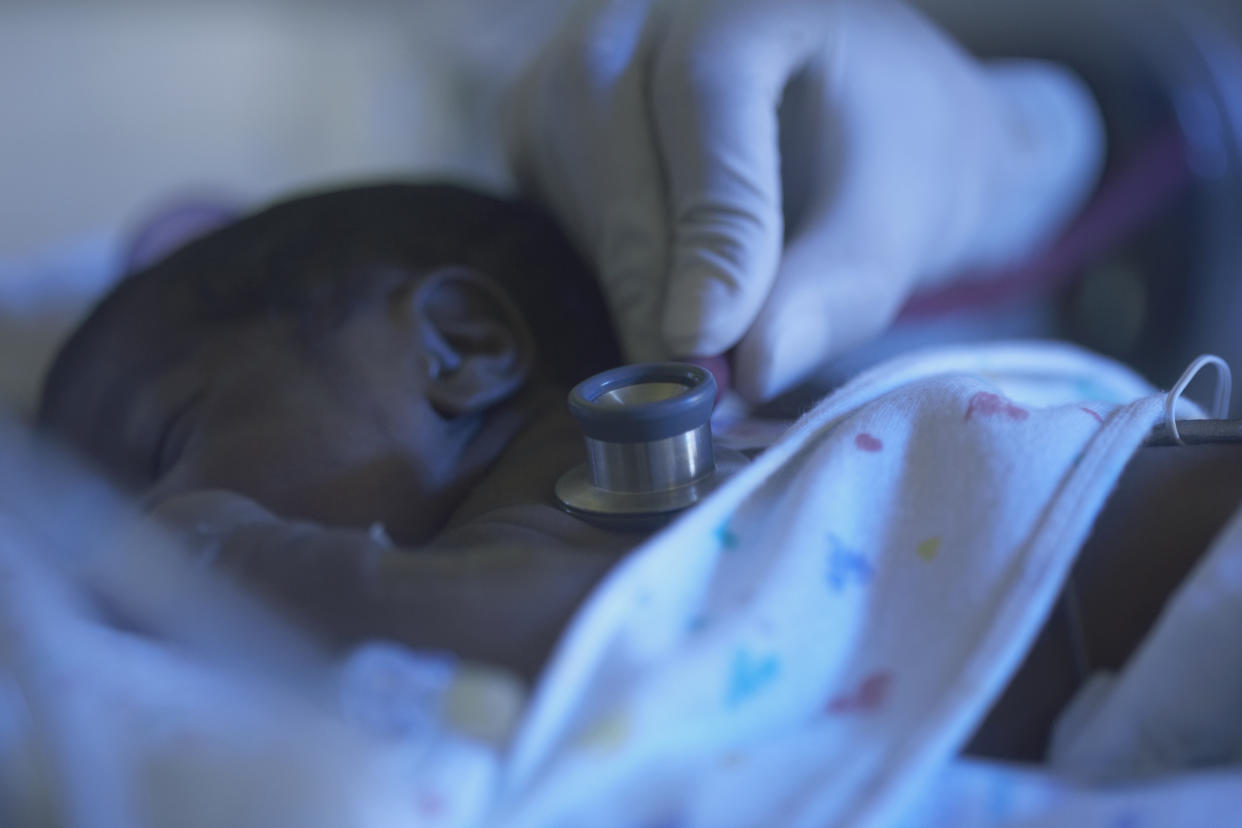 RSV surge - African American premature baby being examined