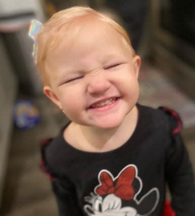 Felicity Peden, 2, suffered injuries after being attacked by her family's four puppies on June 3, 2022 in California. The girl underwent three hours of plastic surgery and was recovering Wednesday, June 15, 2022.