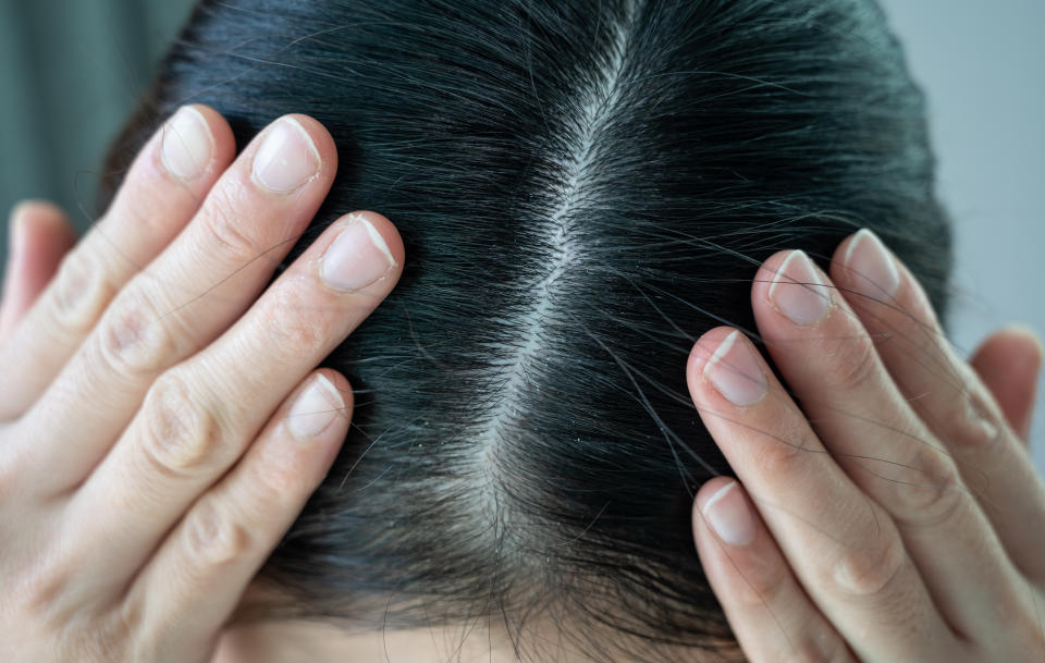 up-close of a person's scalp