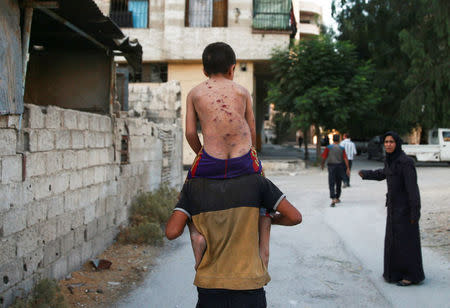 A man carries a wounded boy on his back in Arbin, a town in the Damascus countryside, Syria July 25, 2017. REUTERS/Bassam Khabieh