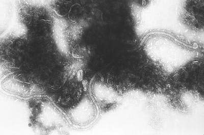 Micrografía electrónica de transmisión del RSV. <a href="https://commons.wikimedia.org/wiki/File:Respiratory_syncytial_virus_01.jpg" rel="nofollow noopener" target="_blank" data-ylk="slk:Wikimedia Commons / CDC;elm:context_link;itc:0;sec:content-canvas" class="link ">Wikimedia Commons / CDC</a>