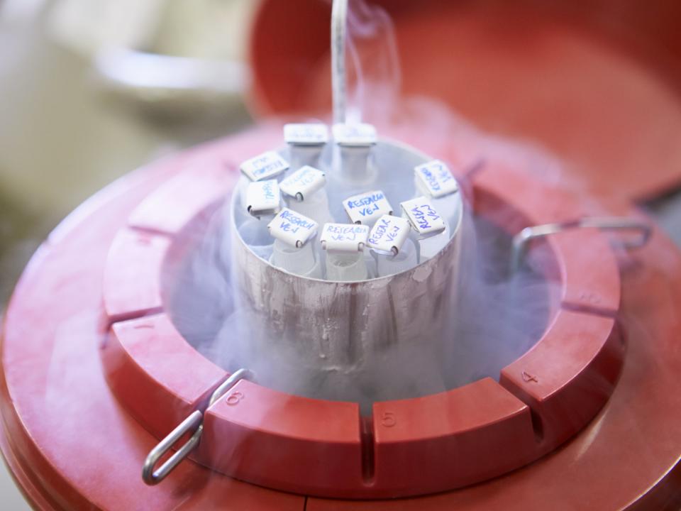 Sperm Bank Frozen Fertility Clinic 