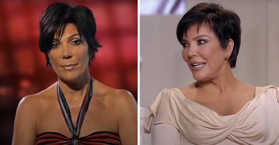 Kris Jenner before and after