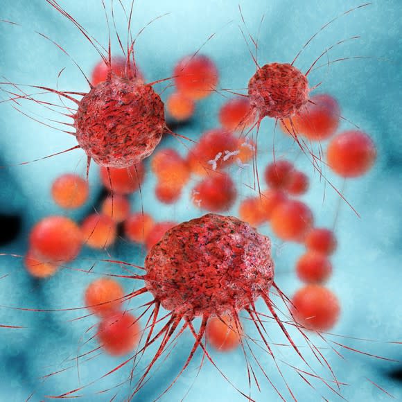 A 3-D rendering of cancer cells.