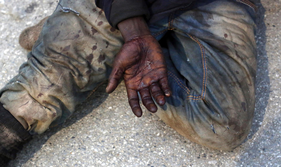 <p>A man shows the injures on his hand as he sits on the ground after storming a fence to enter the Spanish enclave of Ceuta, Spain, Feb. 17, 2017. (Photo: Jesus Moron/AP) </p>