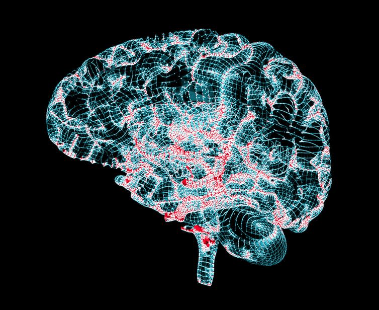 <span class="caption">3D image of a brain - red areas denote damage due to Parkinson’s.</span> <span class="attribution"><a class="link " href="https://www.shutterstock.com/image-illustration/brain-degenerative-diseases-parkinsons-alzheimers-3d-616016804?src=9uyETuUW8gRrRNgnlY-rjw-1-26" rel="nofollow noopener" target="_blank" data-ylk="slk:Shutterstock;elm:context_link;itc:0;sec:content-canvas">Shutterstock</a></span>