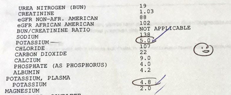 Tim Walters nephrologist gave his recent bloodwork a smily face for having potassium levels in the proper range.