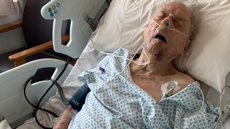 Peter Gouldstone died after an attack left him fighting for his life in hospital.