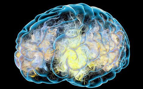 Brain affected by neurological disease