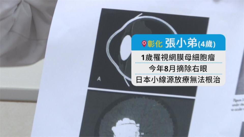 四歲童罹患視網膜母細胞瘤　搶救僅存左眼　赴美治療醫藥費600萬元