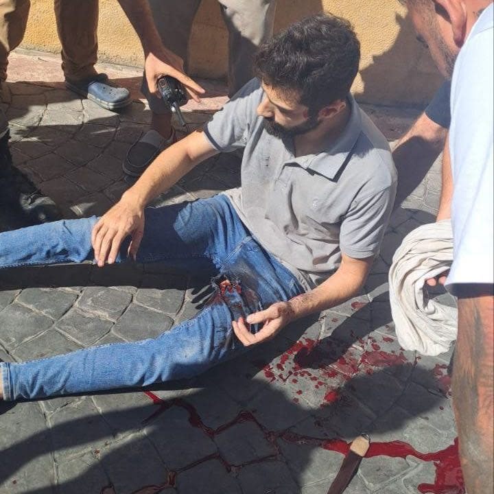 A man sits on the ground bleeding profusely from his groin, with onlookers surrounding him. His jeans are torn