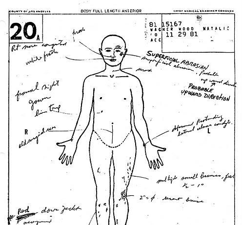 Natalie Wood's autopsy report / Credit: Los Angeles Coroner's Office