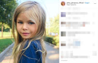 Yakupova è rappresentata dall'agenzia di moda per bambini, President Kids (PK) Management, la stessa che seguiva un'altra giovane modella russa, Anastasia Knyazeva. Quest'ultima si era guadagnata nel 2016, all'età di 6anni, lo scettro di "bambiba più bella del mondo". Prima di loro il titolo era nelle mani della modella francese Thylane Blondeau, figlia del calciatore Patrick Blondeau, che oggi ha 18 anni.