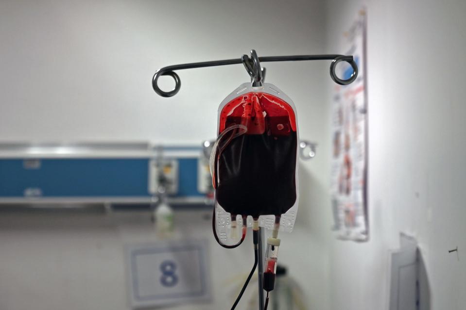 Picture of a blood bag taken as cancer patient Luis Adrian Torreblanca receives his blood transfusion at Hospital Juarez in Mexico City on June 26, 2020 during the COVID-19 novel coronavirus pandemic. - Hospitals in Mexico are struggling due to the lack of blood donors who, afraid of the novel coronavirus, have dropped in numbers. (Photo by Rodrigo ARANGUA / AFP) (Photo by RODRIGO ARANGUA/AFP via Getty Images)