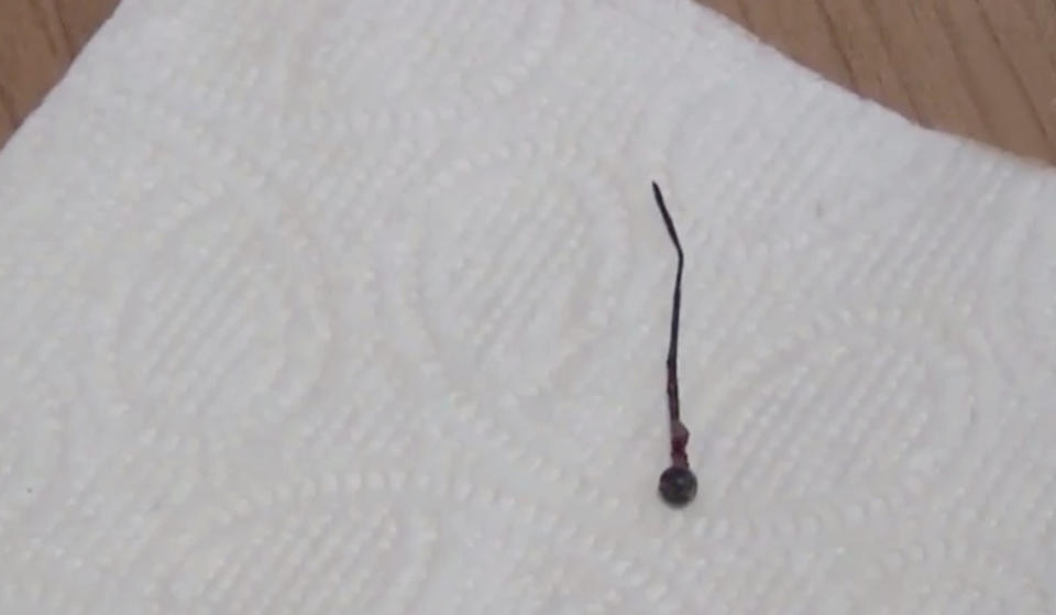 Pictured above is the pin that Ms Sakalloglu swallowed while fastening her scarf. Source: AsiaWire/Australscope