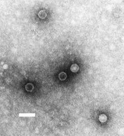 Poliovirus, causante de la poliomielitis en humanos. <a href="https://commons.wikimedia.org/wiki/File:Cholera_bacteria_SEM.jpg" rel="nofollow noopener" target="_blank" data-ylk="slk:Wikimedia Commons / F.P. Williams, U.S. EPA;elm:context_link;itc:0;sec:content-canvas" class="link ">Wikimedia Commons / F.P. Williams, U.S. EPA</a>