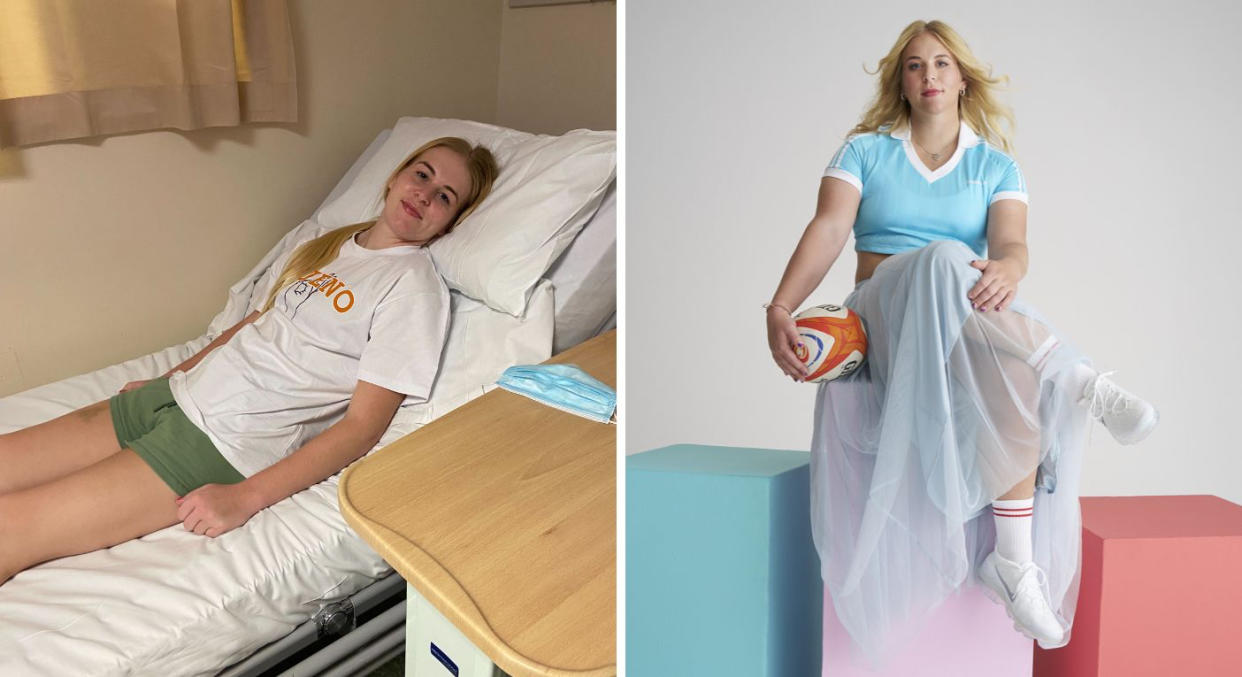 Abi Burton suffered extreme symptoms from mania and aggression to seizures, caused by encephalitis. Image on right, Powered Differently campaign. (Shot by Tara Moore for Getty Images.)