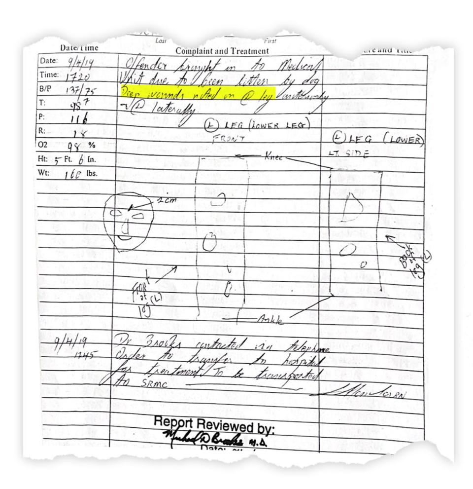 A doctor's rough sketch shows bite wounds on a patient's head and leg.