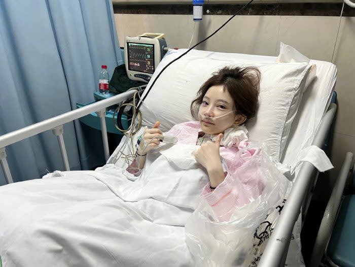 Feng Timo's surgery was a success