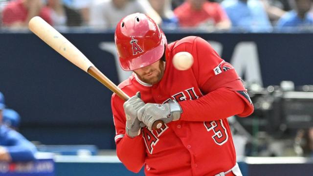 Angels' Taylor Ward suffers facial fractures after taking 91mph pitch to  head, MLB