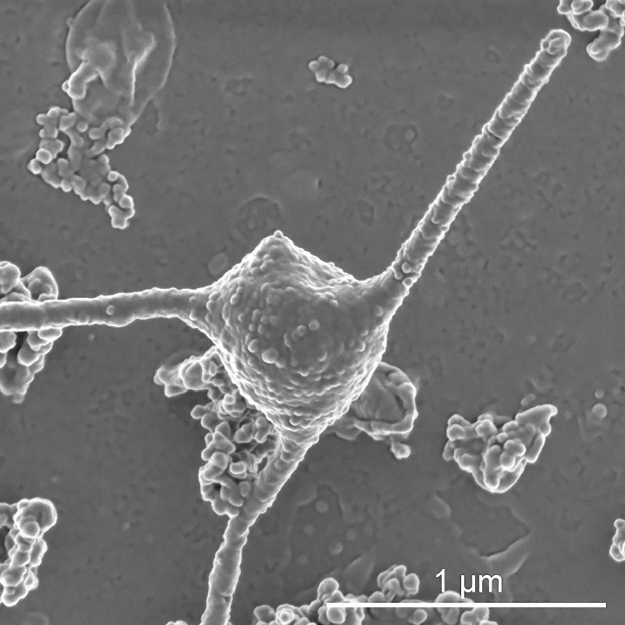 La imagen en un microscopio electrónico de barrido de un Prometheoarchaeum syntrophicum, un microbio que comienza como una pequeña esfera, para luego desarrollar largos tentáculos y liberar burbujas cubiertas de membrana con el paso de los meses. (Hiroyuki Imachi, Masaru K. Nobu y JAMS).