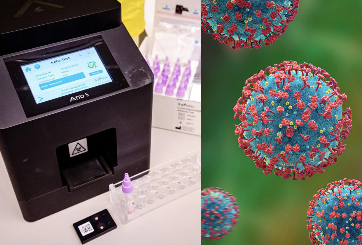 COVID-19 antibodies test kits (right) and the digital reader device (left in black), which can detect levels of COVID-19 antibodies from a drop of blood in just ten minutes. (PHOTOS: NTU Singapore, Getty Images file photo)