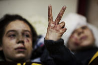 <p>Hana, 12, flashes the victory sign next to her sister Eva, 13, as they recover from severe injuries after the Syrian Army shelled their house in Idlib, in northern Syria, on March 10, 2012. Their father and two siblings were killed after their home was shelled. (Photo: Rodrigo Abd/AP) </p>