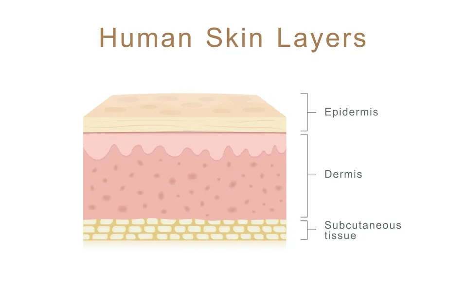 The majority of skin cancers arise from cells within the epidermis, or top layer, of the skin. <a href=