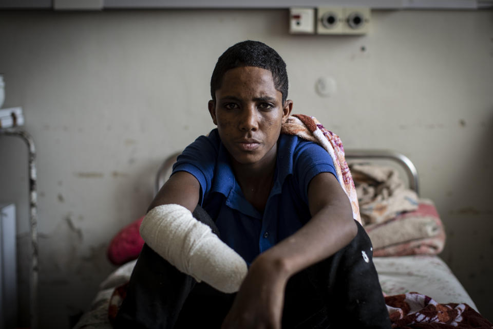 Haftom Gebretsadik, a 17-year-old from Freweini, Ethiopia, near Hawzen, who had his right hand amputated and lost fingers on his left after an artillery round struck his home in March, sits on his bed at the Ayder Referral Hospital in Mekele, in the Tigray region of northern Ethiopia, on Thursday, May 6, 2021. “I am very worried,” he said. “How can I work?” (AP Photo/Ben Curtis)