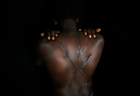 FILE PHOTO: Hassan Mekki, a 32-year-old Sudanese migrant, shows scars on his back in Athens, Greece, December 5, 2012. Mekki, who fled conflict in his country in hope of a better life in Europe, said that on August 2012, about five months after he illegally entered Greece, he and a friend from Mauritania were walking in Athens when black-shirted men on motorcycles holding Greek flags came up and knocked him half-conscious with a blow to the head. When he regained consciousness, he was covered in blood. Only later would he realise that his attackers, which he says were likely tied to the far-right Golden Dawn party, had left large gashes resembling an "X" across his back. "I don't have the right papers, so I can't go anywhere to ask for help," Mekki said. "I can't sleep. I'm scared, maybe they will follow me and my life is in danger now." REUTERS/Yannis Behrakis/File photo