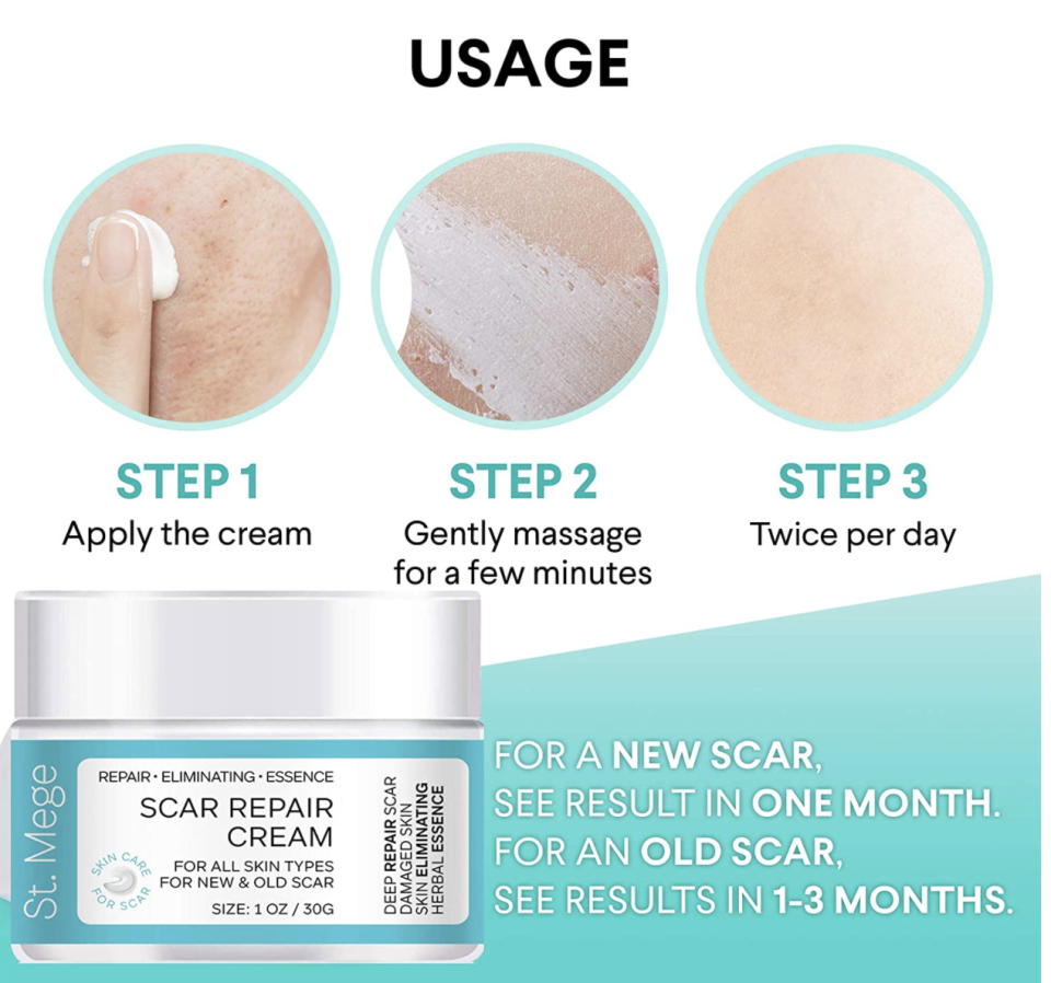 St. Mege Scar Removal Cream (Photo via Amazon)