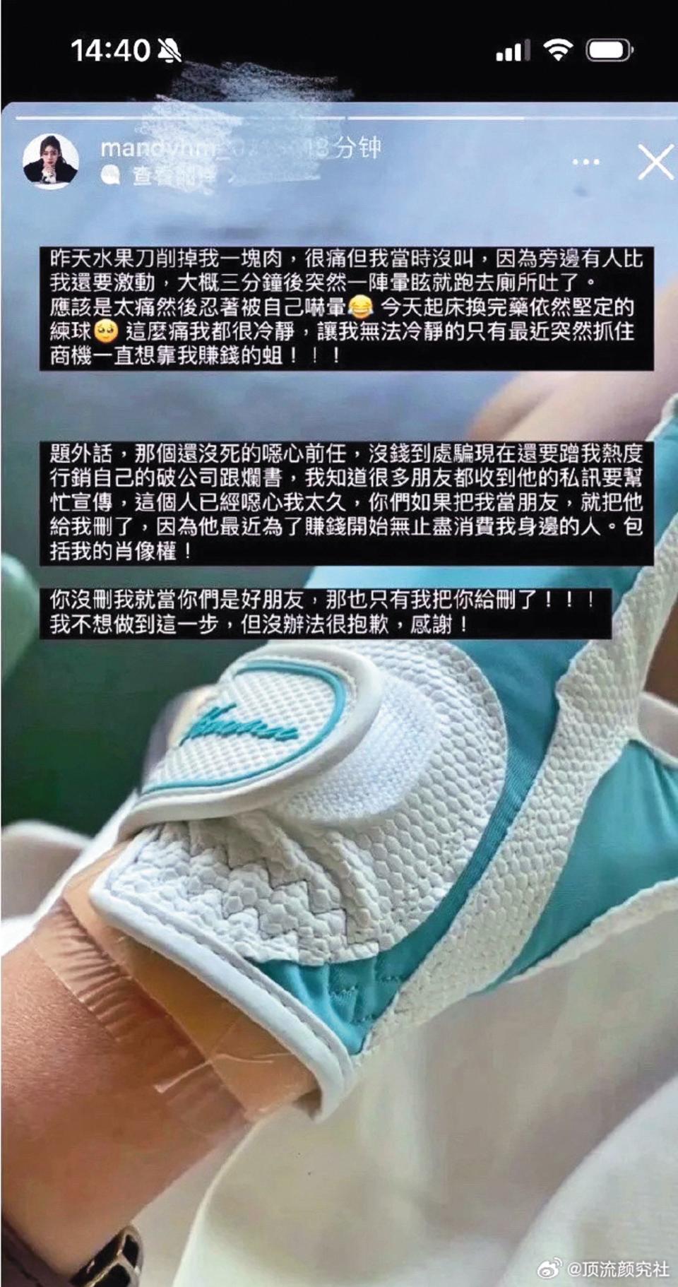 日前汪小菲未婚妻Mandy在網路上發文，除曬出受傷的手部照片，也開罵前任消費她。（翻攝自微博）