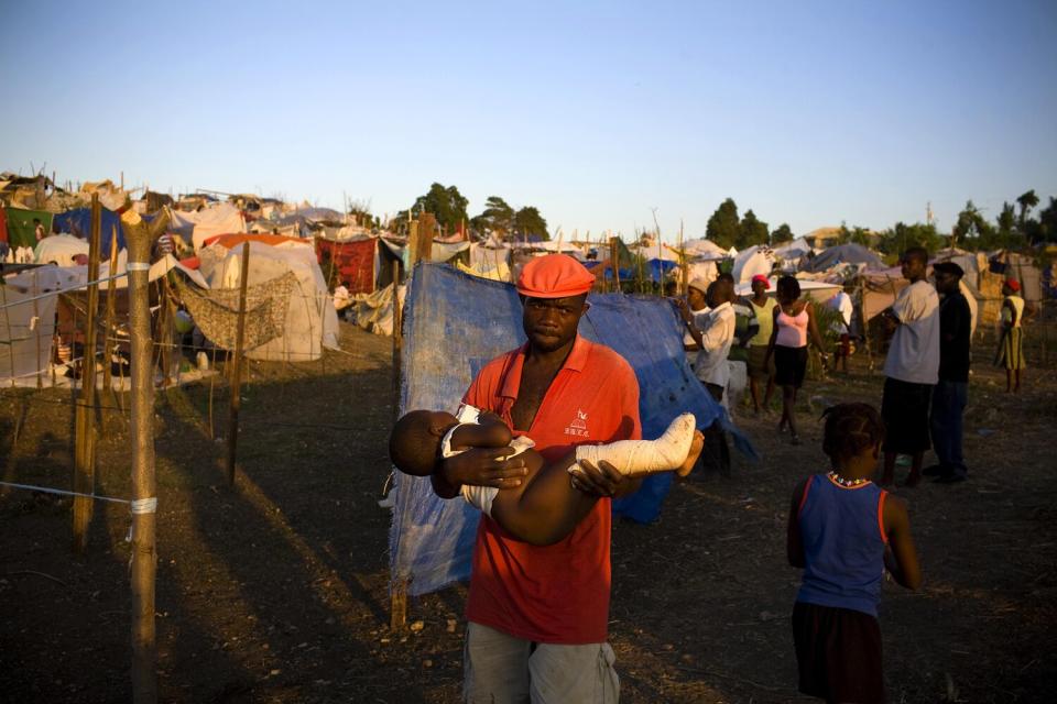 A refugee holds an injured child in a tent city.