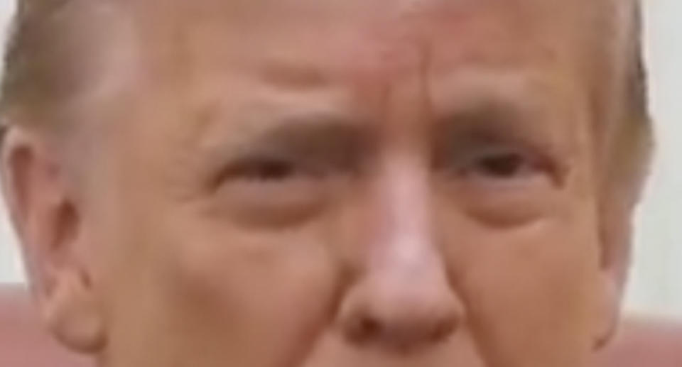 A close-up of Trump's eyes show them looking droopy and sad.