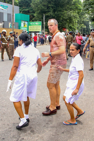 An injured tourist crosses the road in front of the National Hospital at Colombo, Sri Lanka, on April 21, 2019. -At least 137 people were killed in Sri Lanka on April 21, police sources told AFP, when a string of blasts ripped through high-end hotels and churches as worshipers attended Easter services (Photo by Tharaka Basnayaka/NurPhoto via Getty Images