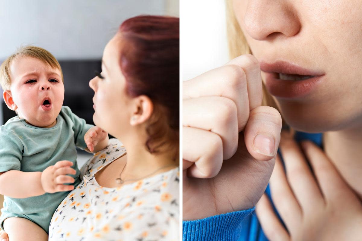 Whooping cough (pertussis), also known as the 100-day cough, is a bacterial infection of the lungs and breathing tubes, according to the NHS <i>(Image: Getty Images)</i>