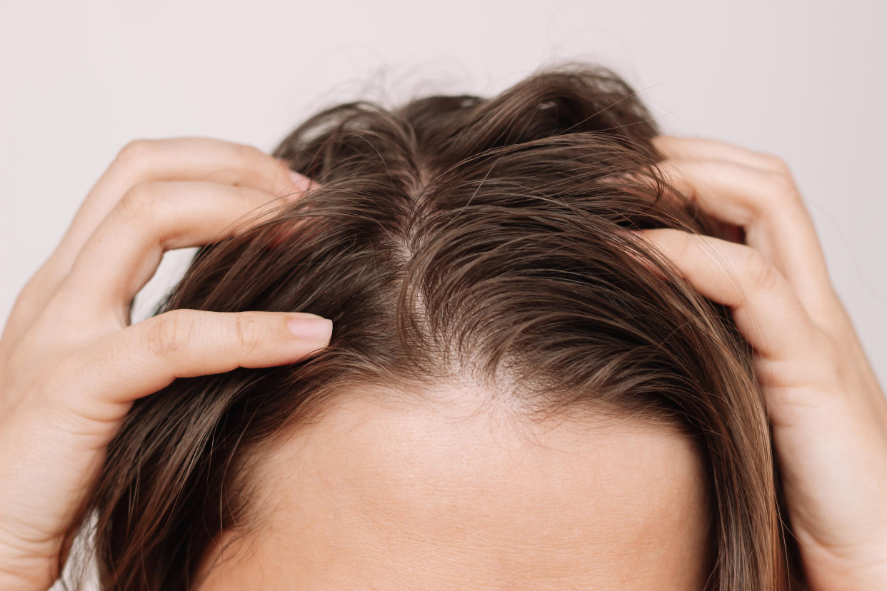 Ungewaschenes Haar? Kein Problem mehr. (Symbolbild: Getty)