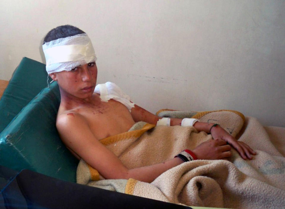 In this photo released by the Syrian official news agency SANA, a Syrian boy who was injured by a car bomb lies on a hospital bed in Hama, Syria, Friday, May 2, 2014. Syrian state-run television said vehicles exploded in Jadreen and Humayri villages, which are under government control, in the central province of Hama. More than a dozen were killed and wounded, including several children. (AP Photo/SANA)