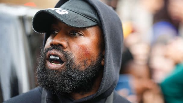 PHOTO: Kanye West aka Ye is seen wearing a Balenciaga boxing mouth guard, outside Givenchy, during Paris Fashion Week, Oct., 2, 2022 in Paris. (Edward Berthelot/GC Images via Getty Images)