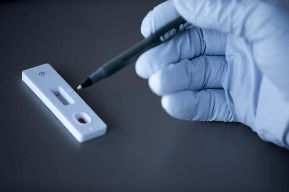 A test plate indicating negative results for an antibody test for coronavirus