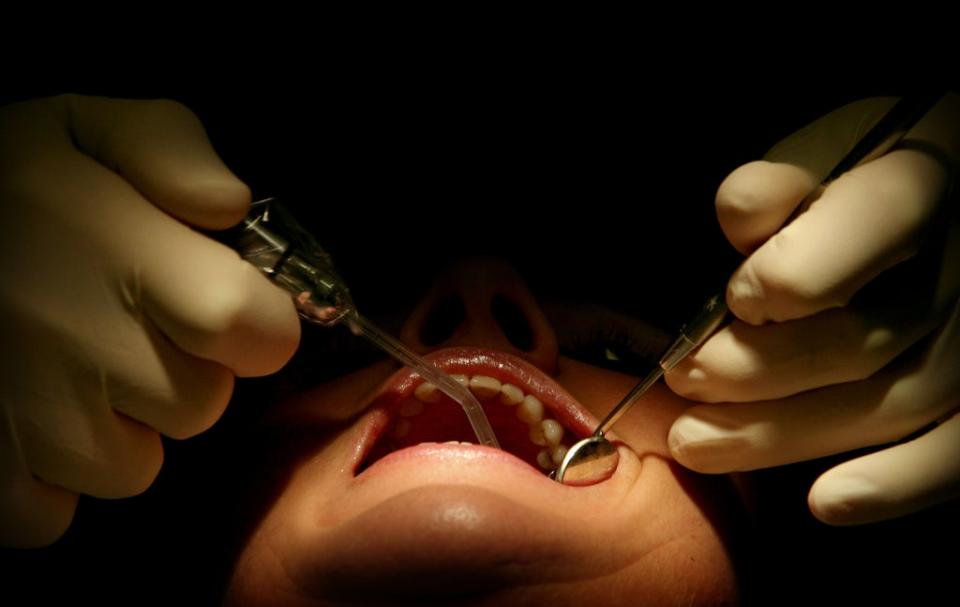 A £50 million catch-up fund has been announced for dentists in England (Anthony Devlin/PA) (PA Archive)